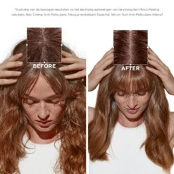 Kérastase Kerastase Symbiose Micro-Peeling Cellulaire 200ml -Winkel Voor Haarproducten 3474637135744 13