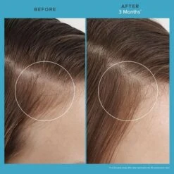 Living Proof Scalp Care Revitalizing Treatment 73ml 7 Living Proof Scalp Care Revitalizing Treatment 73ml -Winkel Voor Haarproducten scalp care revitalizing treatment 5